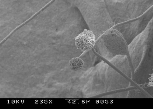 Tipos de microscopios - Microscopio de contraste de fases